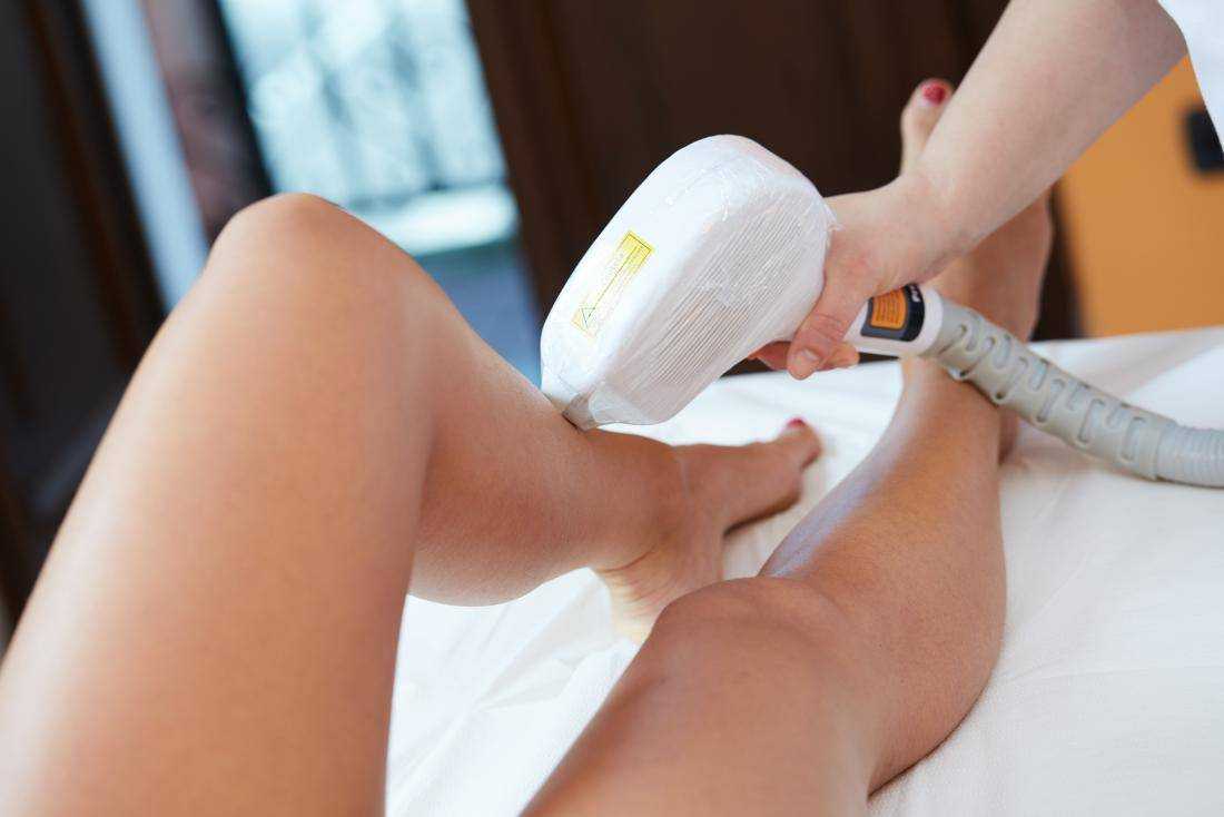 Laser Hair Removal in Kathmandu