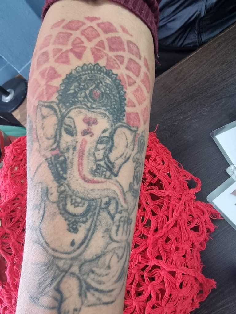 Big size complex multicolor tattoo removal price in kathmandu, nepal